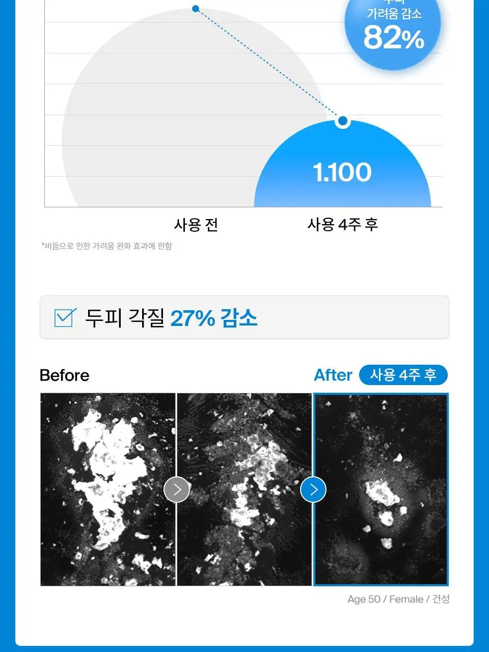 [비듬샴푸 단독기획] 닥터포헤어 에어로 퓨리파잉 안티댄드러프 비듬샴푸 400ml 기획 (+70ml) 상세페이지 11